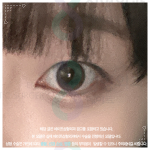 속쌍꺼풀 수술 티안나려면 인라인으로 해야할까? 관련 이미지 4