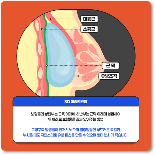 Breast Augmentation Surgery Review: Implants, Recovery Time, and How to Minimize Side Effects image 11