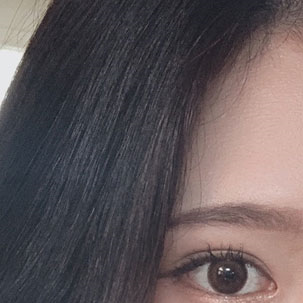 눈성형외과 내게 맞는 눈성형을 찾아요 관련 이미지 13