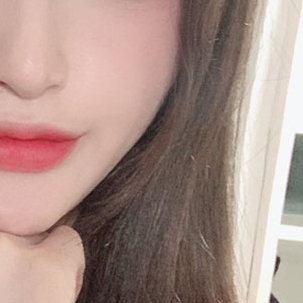 눈성형외과 내게 맞는 눈성형을 찾아요 관련 이미지 20