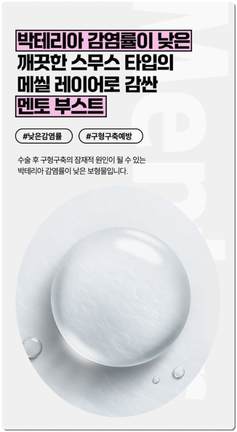 멘토 엑스트라 하이 타입? 스무스 차이, 부스트까지 비교해보면 비용은 어느 정도일까 관련 이미지 25