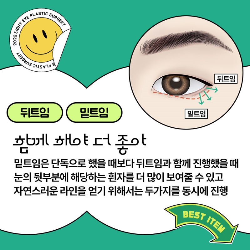 If You Compare Reviews of Outer and Lower Canthoplasty Carefully image 5