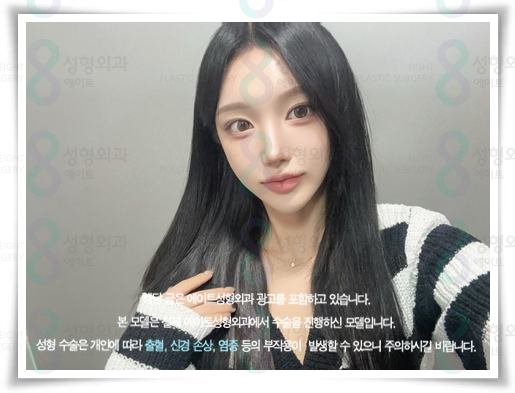 코끝수술 잘하는곳, 예쁜 후기, 가격 정보, 콧볼축소 뭐가 다른가요? 관련 이미지 4