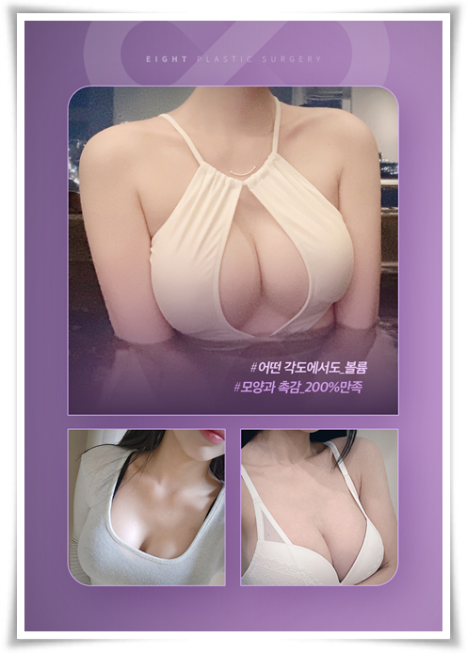 모티바 가슴수술 가격? 수술 후 촉감, 구형구축 문제없나요? 관련 이미지 22