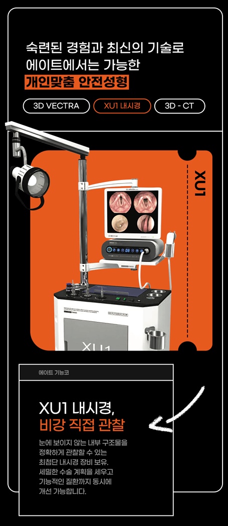About the Difference in Hump Nose Surgery Costs Before and After for Women image 10