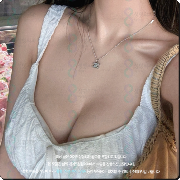Breast Augmentation Surgery Cost (Price) and the Secret to a Review with No Side Effects Before and After? image 3