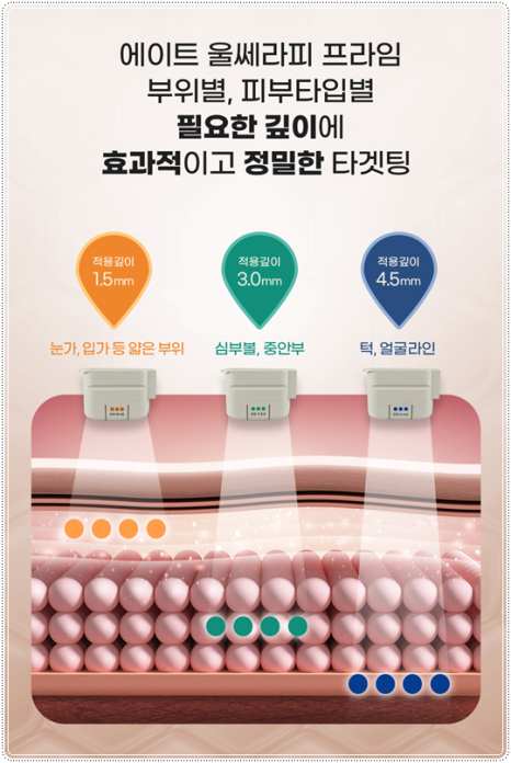 When You’re Unsure About the Difference Between 300 and 600 Ulthera Shots, Here’s What Matters More Than Cost image 13
