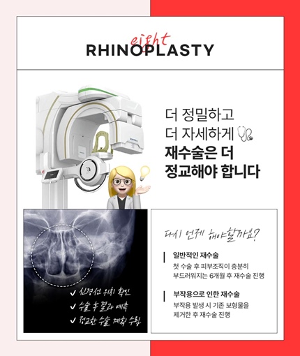 Famous Clinic for Nose Revision Surgery&nbsp;Best Place for Nose Revision Surgery in Gangnam&nbsp;Famous Place for Nose Revision Surgery in Seoul image 9