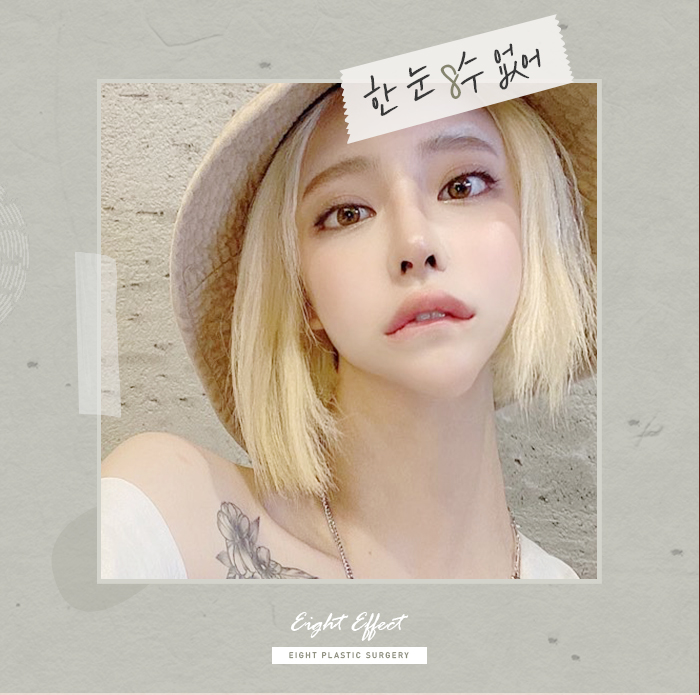 V라인사각턱 자갈턱 돌려깎기 관련 이미지 3