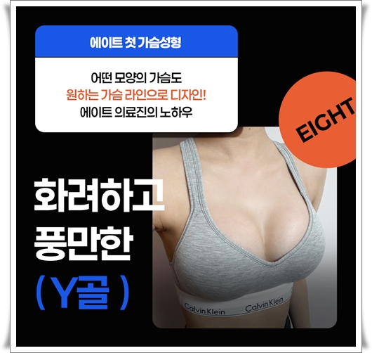 가슴확대수술비용 차이는 왜 나나요? 관련 이미지 12