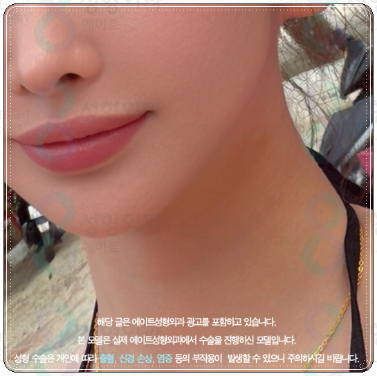 How to Choose a Clinic and Check Prices When Looking into Ulthera in Apgujeong image 3