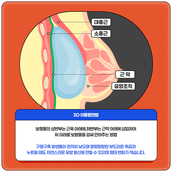 처진가슴수술 비용 (가격), 처짐 개선 방법은? 후기, 회복기간 어떤가요? 관련 이미지 11