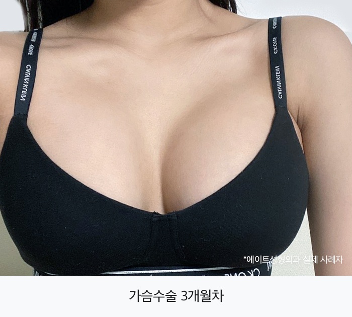 강남가슴수술 자신감까지 채우게 관련 이미지 4