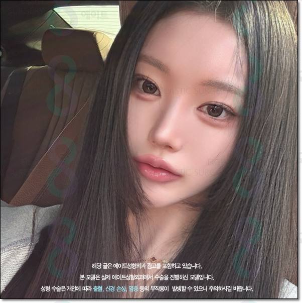 남자와 여자 차이? 매부리코는 수술 가격이 다를까요? 관련 이미지 1