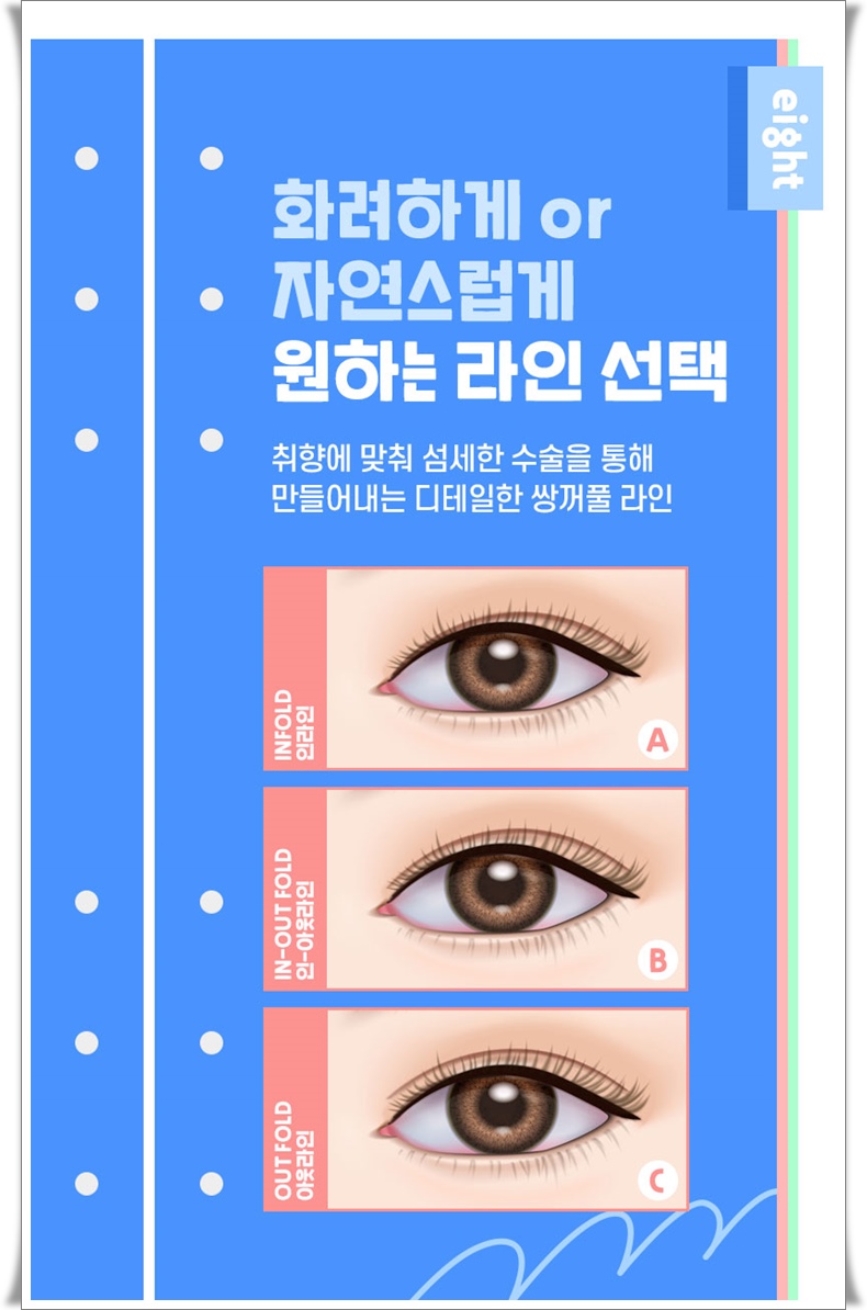 자연유착 쌍꺼풀 가격 확인해볼까요? 관련 이미지 3