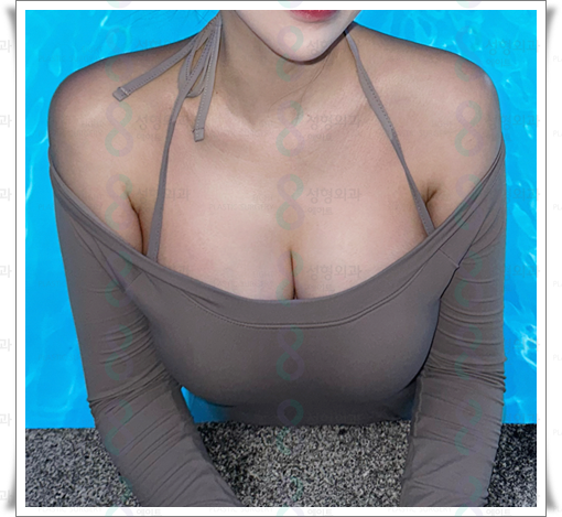 Breast Augmentation Surgery Cost Based on Mentor Implants image 2