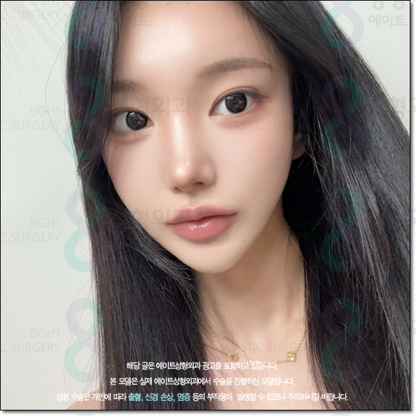 남자와 여자 차이? 매부리코는 수술 가격이 다를까요? 관련 이미지 3