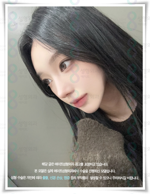 코끝수술 잘하는곳, 예쁜 후기, 가격 정보, 콧볼축소 뭐가 다른가요? 관련 이미지 2