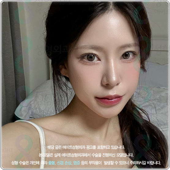 What Is the Average Price of Rhinoplasty When Hump Nose Surgery and Crooked Nose Surgery Are Performed Together? image 2