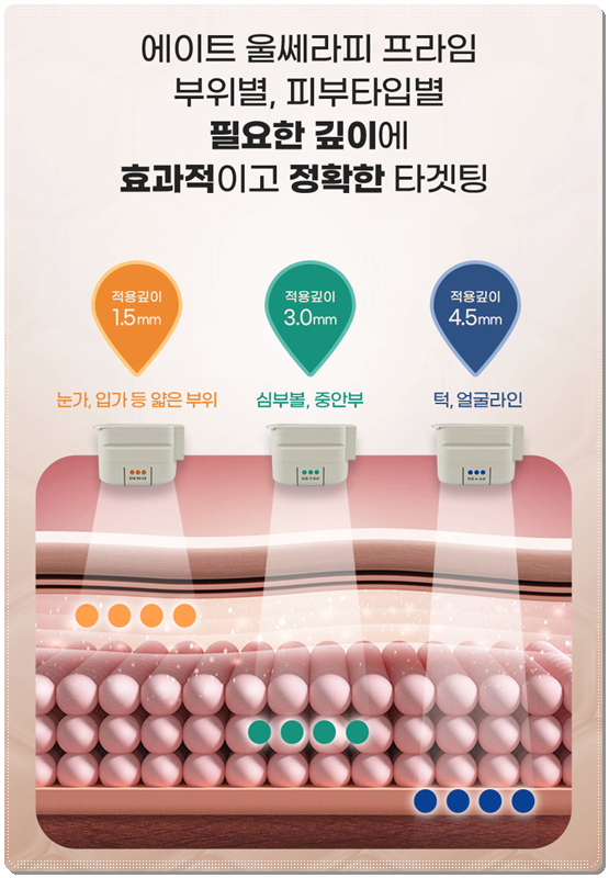 울쎄라 300샷 가격과 효과는? 100샷 후기&middot;전후 차이까지 비교 관련 이미지 14