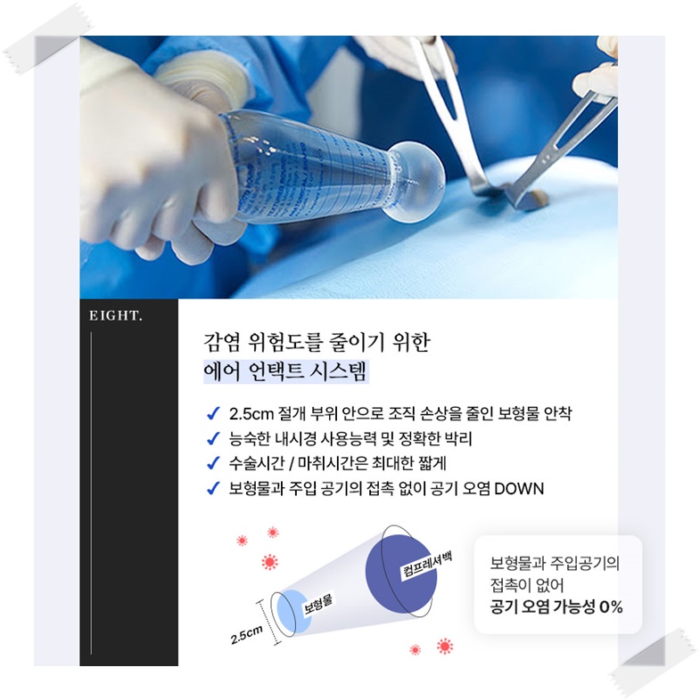 가슴보형물종류 어떤것이 좋은걸까? 관련 이미지 3