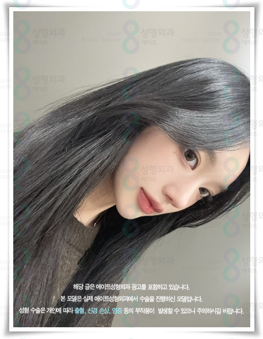 코끝수술 잘하는곳, 예쁜 후기, 가격 정보, 콧볼축소 뭐가 다른가요? 관련 이미지 1