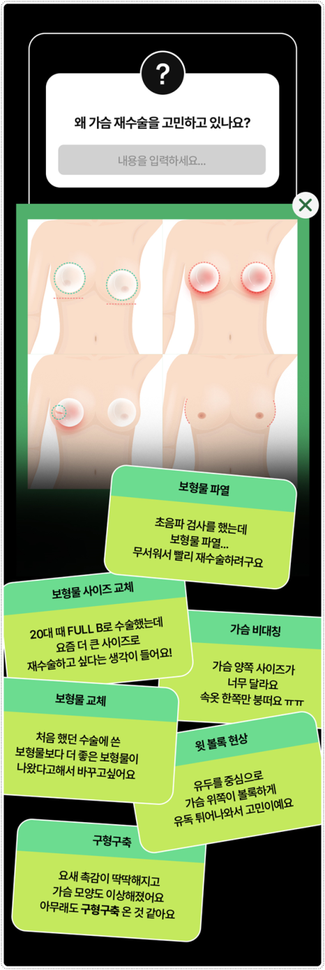 가슴 재수술 흉터, 통증 걱정이 될 때, 알맞은 시기와 생생한 후기 찾아보기 관련 이미지 6