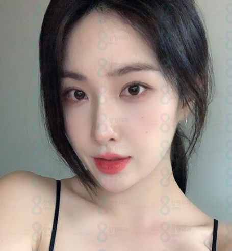Gangnam, Apgujeong Eye Bag Fat Repositioning Surgery Hospital, Well-Known Eye Bag Fat Repositioning Hospital image 1