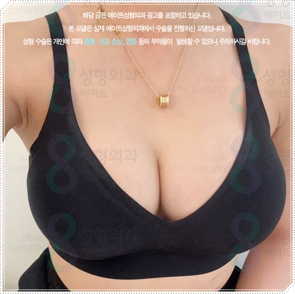 절벽 가슴도 가슴확대 수술로 커질 수 있을까? (비용, 촉감에 대해) 관련 이미지 3