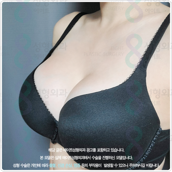 가슴 재수술 흉터, 통증 걱정이 될 때, 알맞은 시기와 생생한 후기 찾아보기 관련 이미지 1