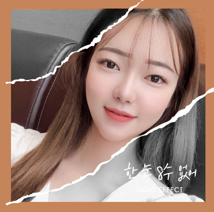 코성형가격 매부리코 코끝성형 짧은코 짧은코재수술 관련 이미지 3