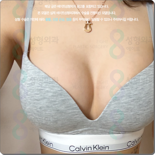 압구정역 가슴수술, 성형외과 추천? 멘토 엑스트라는 비용 전에 가슴 트레이닝센터, 의사를 확인 관련 이미지 3