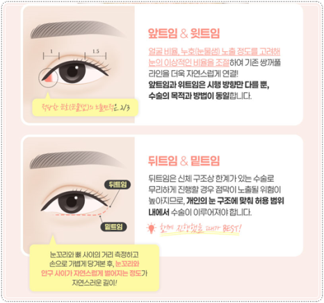 Preparing for the Cost and Swelling When Combining Medial and Lateral Canthoplasty with Double-Eyelid Surgery: A Comparison image 14