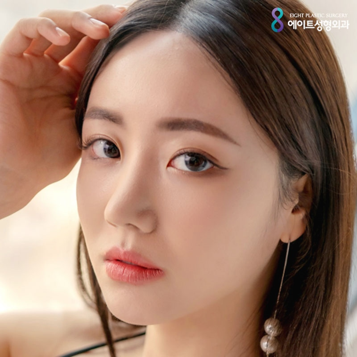 눈 뒤트임 앞트임 위트임 밑트임 에이트풀트임 관련 이미지 6