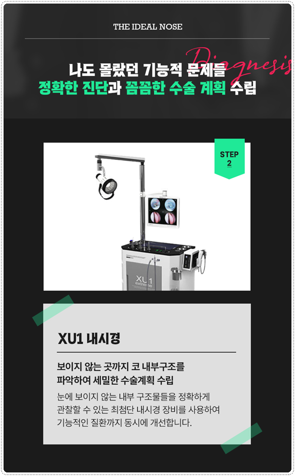 복코성형 콧볼축소 1개월 차! 코성형 붓기 빨리 빼는법과 코끝수술 후기 찾으셨나요? 관련 이미지 13