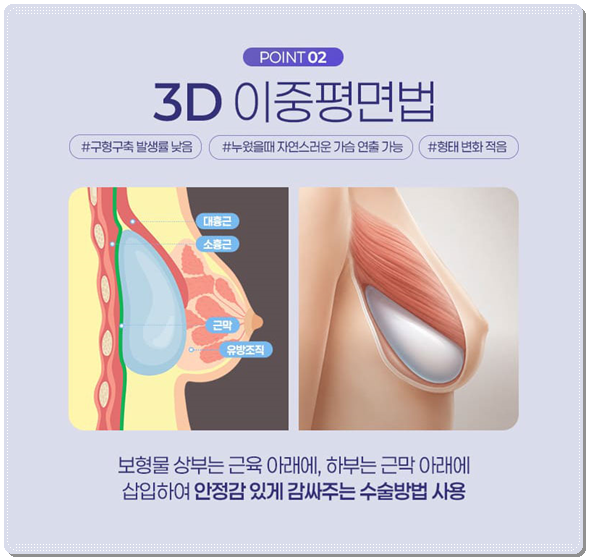 가슴재수술부터 처진가슴 거상술까지, 보형물 교체와 제거 방법 관련 이미지 12