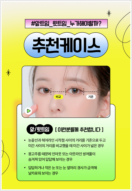 쌍꺼풀 자연유착과 매몰, 절개 사이에서 고민이라면? 비용과 풀림 가능성을 낮추는 수술 방법은? 관련 이미지 10