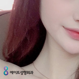눈성형외과 내게 맞는 눈성형을 찾아요 관련 이미지 11