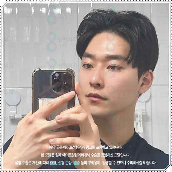 남자 코성형 종류 어떤 게 맞을까? 평균 비용부터 회복기간, 발품 팁까지 완벽 가이드 관련 이미지 1