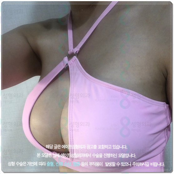 멘토 엑스트라 하이 타입? 스무스 차이, 부스트까지 비교해보면 비용은 어느 정도일까 관련 이미지 4