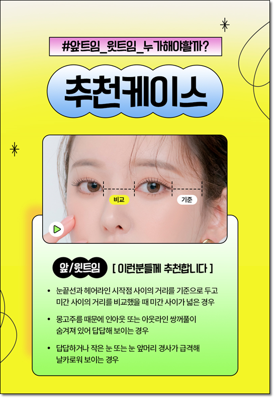 쌍커풀 수술을 고민하신다면? 매몰법의 전후 변화와 비용까지 꼼꼼히 체크하세요 관련 이미지 10