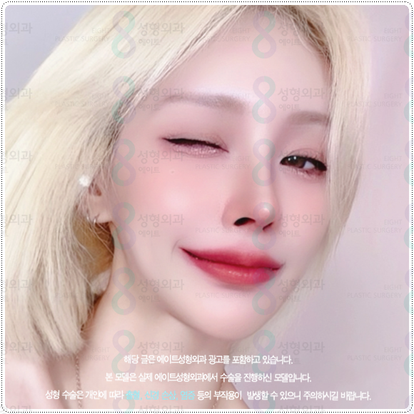 복코성형 콧볼축소 1개월 차! 코성형 붓기 빨리 빼는법과 코끝수술 후기 찾으셨나요? 관련 이미지 2