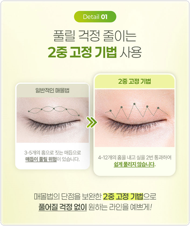 Suture or Incision? Which Double-Eyelid Design Looks Best? Understanding the Differences Between In-Out and In-Line Creases, Including the Semi-Out Line image 8