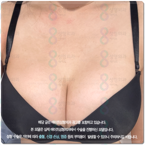 멘토 엑스트라 하이 타입? 스무스 차이, 부스트까지 비교해보면 비용은 어느 정도일까 관련 이미지 3