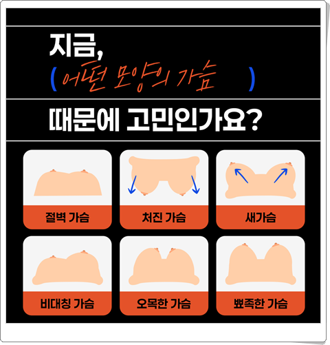 가슴확대수술비용 부작용 가능성을 낮추려면? 관련 이미지 12