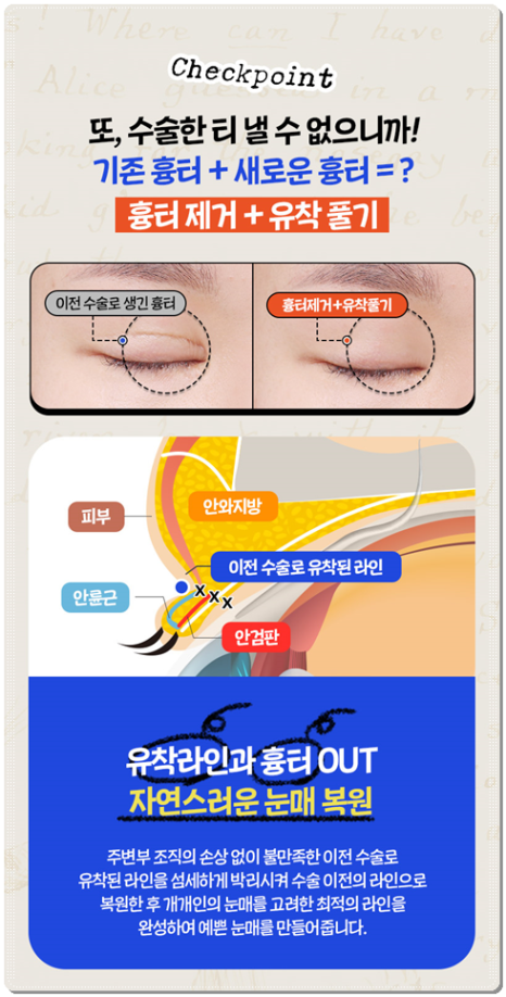 수술 가격이 다른 이유? 매몰과 절개 어떤 쌍꺼풀 재수술을 해야할까? 관련 이미지 6