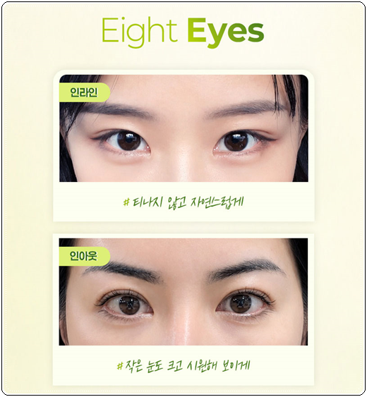 세미아웃라인 쌍수를 매몰로 하는법? 발품 비용 상담 후기 참고용 관련 이미지 8