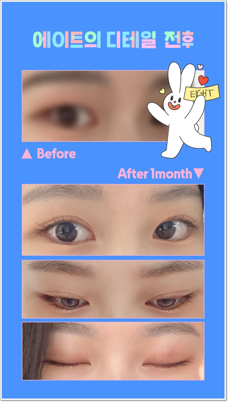 What Are the Criteria for Finding a Good Eye Surgery Clinic? image 6