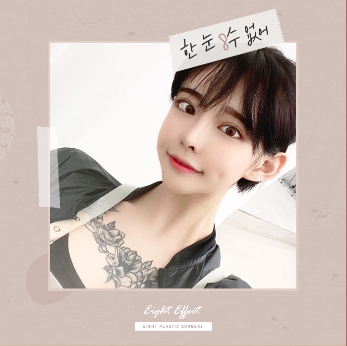 V라인사각턱 자갈턱 돌려깎기 관련 이미지 1