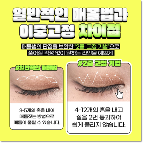 쌍수 가격은 평균적으로 얼마일까요? 매몰과 비절개? 절개 차이점까지 관련 이미지 11
